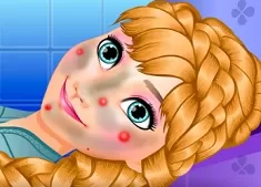 Frozen  Games, Anna Skin Treatment, Games-kids.com