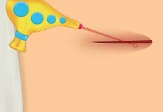 Doctor Games, Hip Surgery 2, Games-kids.com